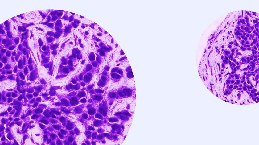 oncology cell