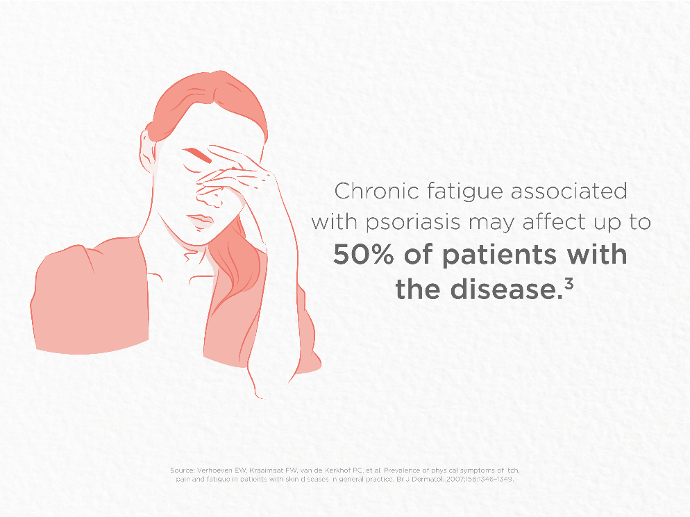 Chronic Fatigue